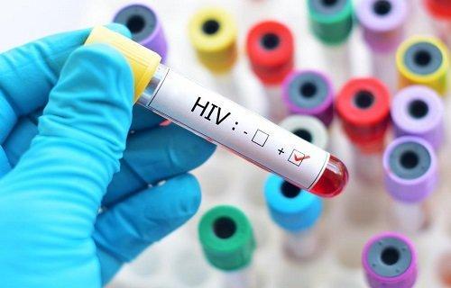 واکنش دانشگاه علوم پزشکی چهارمحال و بختیاری به ابتلای تعدادی از اهالی یک روستا به HIV