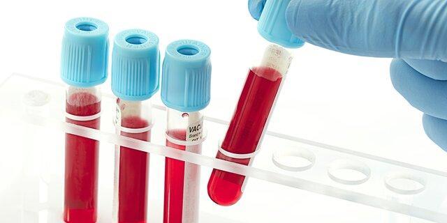انتخاب بانک سلول های بنیادی خون قاعدگی به عنوان دستاورد برتر