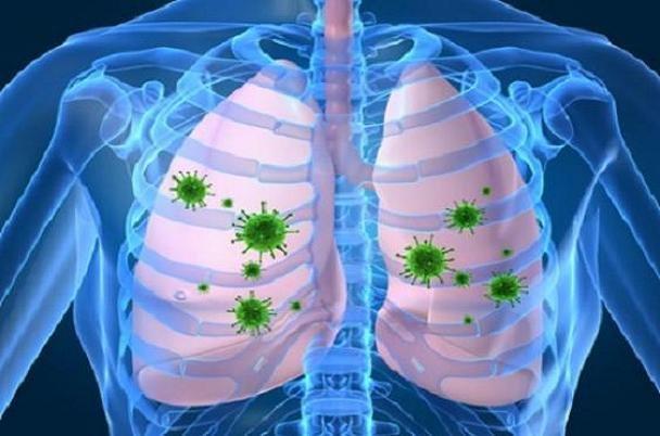 مبتلایان HIV با ریسک بالای بیماری انسداد مزمن ریوی روبرو اند