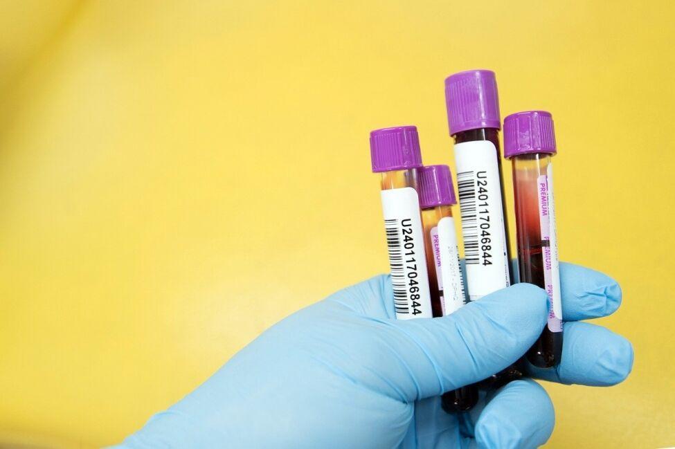 خبرنگاران تشخیص موارد خطرناک کرونا با آزمایش خون