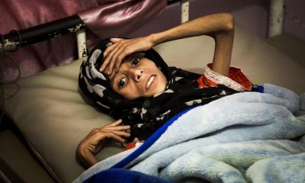 گاردین: جنگ و قحطی می تواند نسل بعدی یمنی ها را نابود کند
